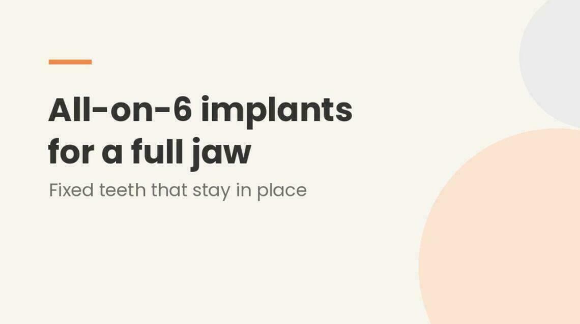 All-on-6 Dental Implants: Fixed Teeth for a Full Jaw