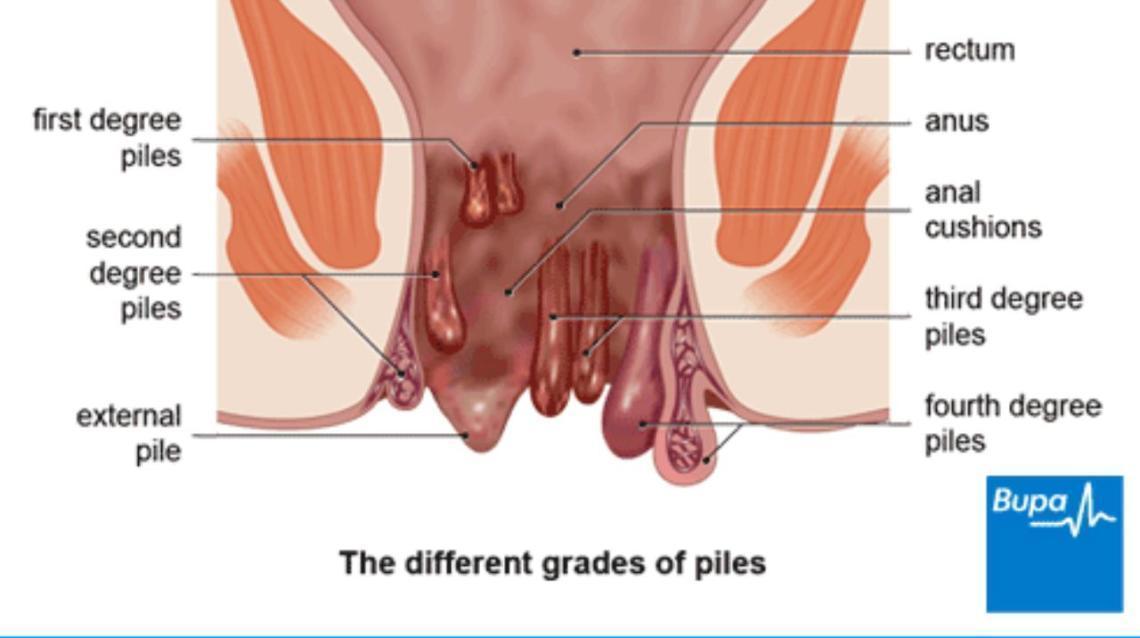 https://www.practostatic.com/fit/bb7242ce4dc43a716b2f688a339e14fe630eeabd