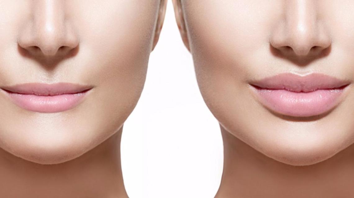 What Would Make Lips Go Number One