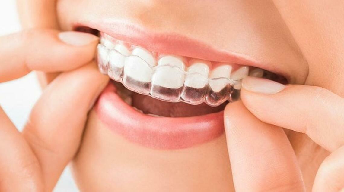 Invisalign in Mira Road – Straighten Your Smile Invisibly