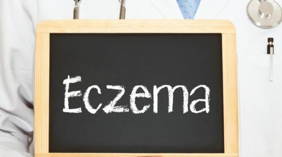 Management of Atopic Eczema