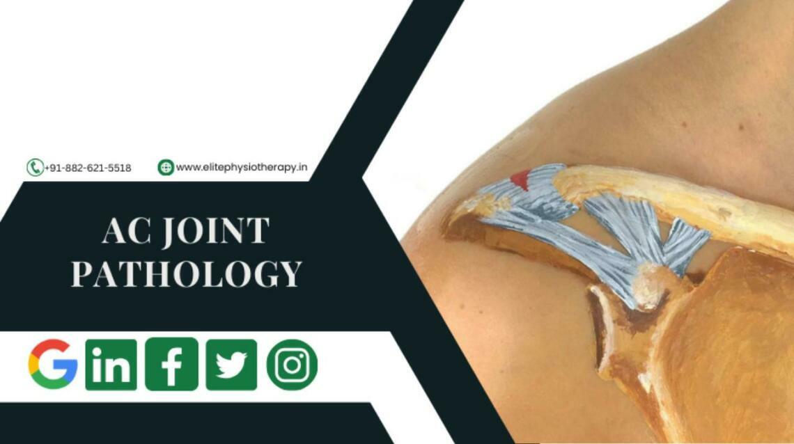 Shoulder Pain: Ac Joint Pathology