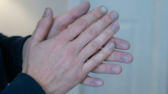 6 Reasons Your Hands and Feet Feel Cold More Often Than Before