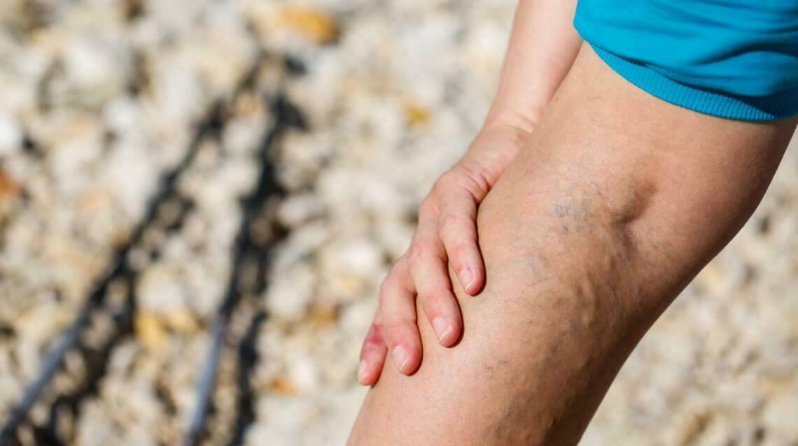 5 treatments for Osteoarthritis Knee.