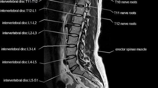 Spine Mobilization Related Articles Q A Doctors Practo