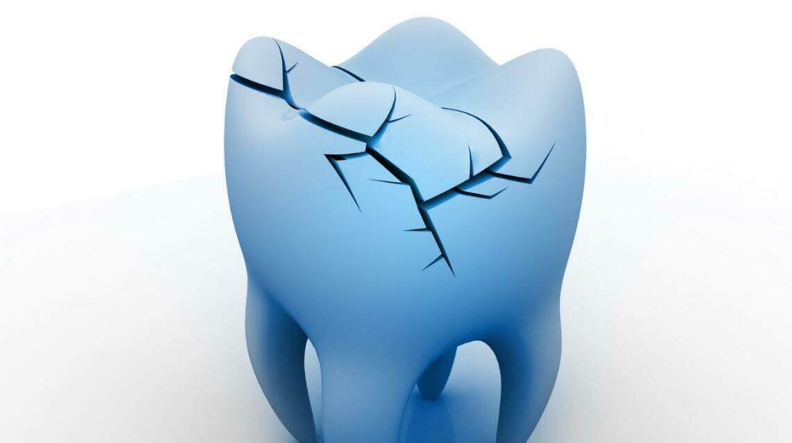 Why You Still Have Pain After Root Canal Treatment