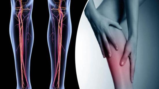 Deep Vein Thrombosis (DVT) and Pulmonary Embolism (PE): Threats to a healthy life