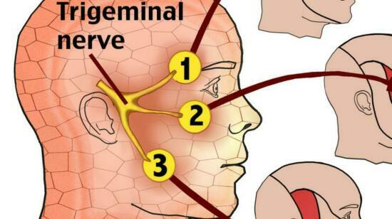 Trigeminal Neuralgia Treatment in Ahmedbad