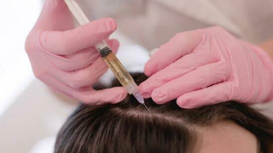 Prp vs Exosomes: Which Hair Regrowth Treatment Actually Works Better?