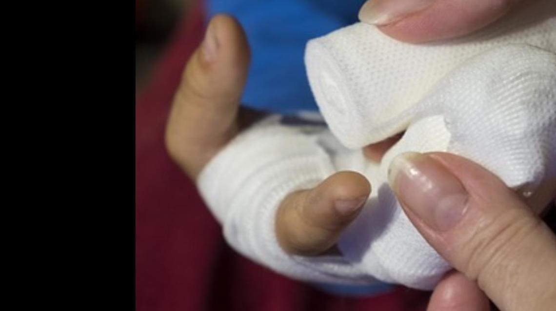 5 Ways to Recover Well From a Sports Injury