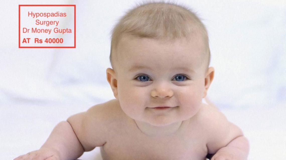 Low Cost Hypospadias Surgery