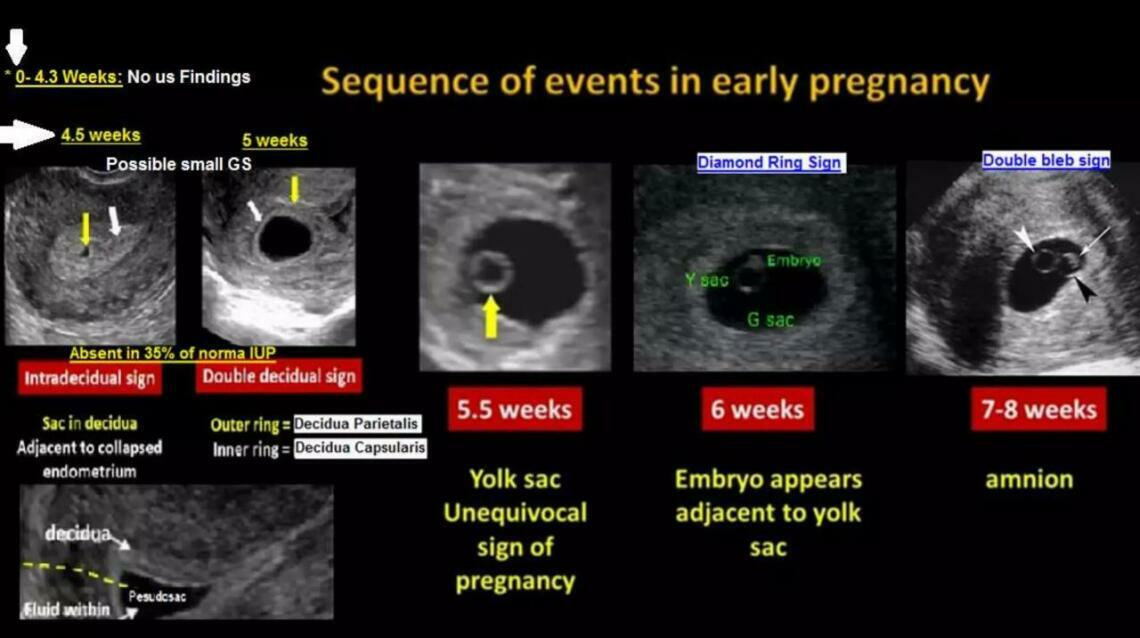 Dr. Nupur Mital's Pregnancy Care Series Part 1: