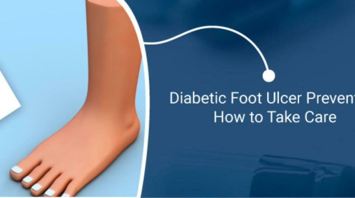 5 Ways to Prevent Diabetic Foot Ulcer