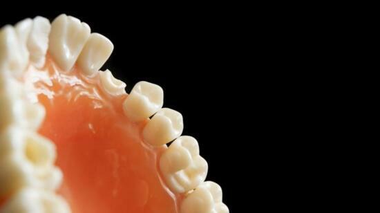 Common Causes of Tooth Loss and How to Prevent Them