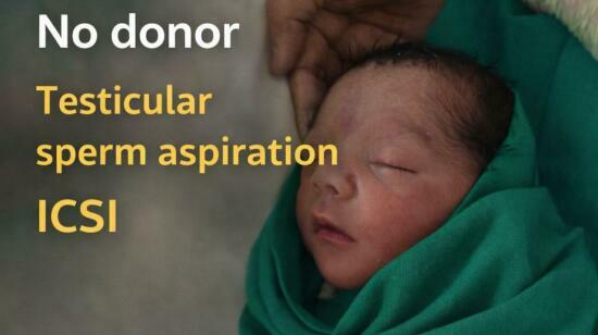 Azoospermia- You Do Not Need Donor Sperms