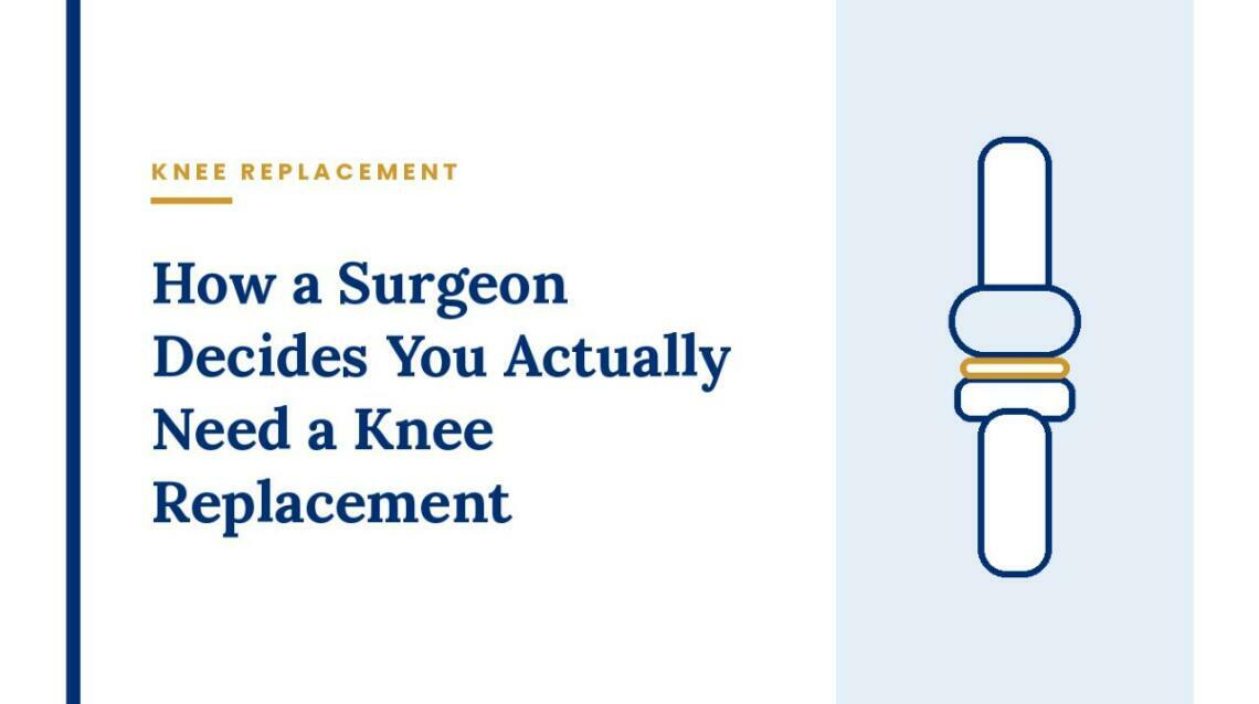 How a Surgeon Decides You Actually Need a Knee Replacement