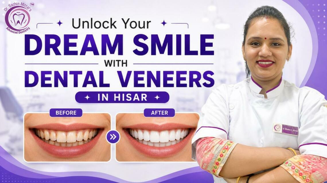 Unlock Your Dream Smile With Dental Veneers in Hisar