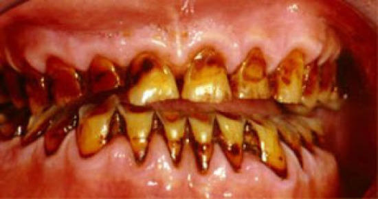 different types of tobacco leaves Tobacco plants over-expressing the sweet orange tau glutathione  transferases (CsGSTUs) acquire tolerance to the diphenyl ether herbicide  fluorodifen and to salt and drought stresses