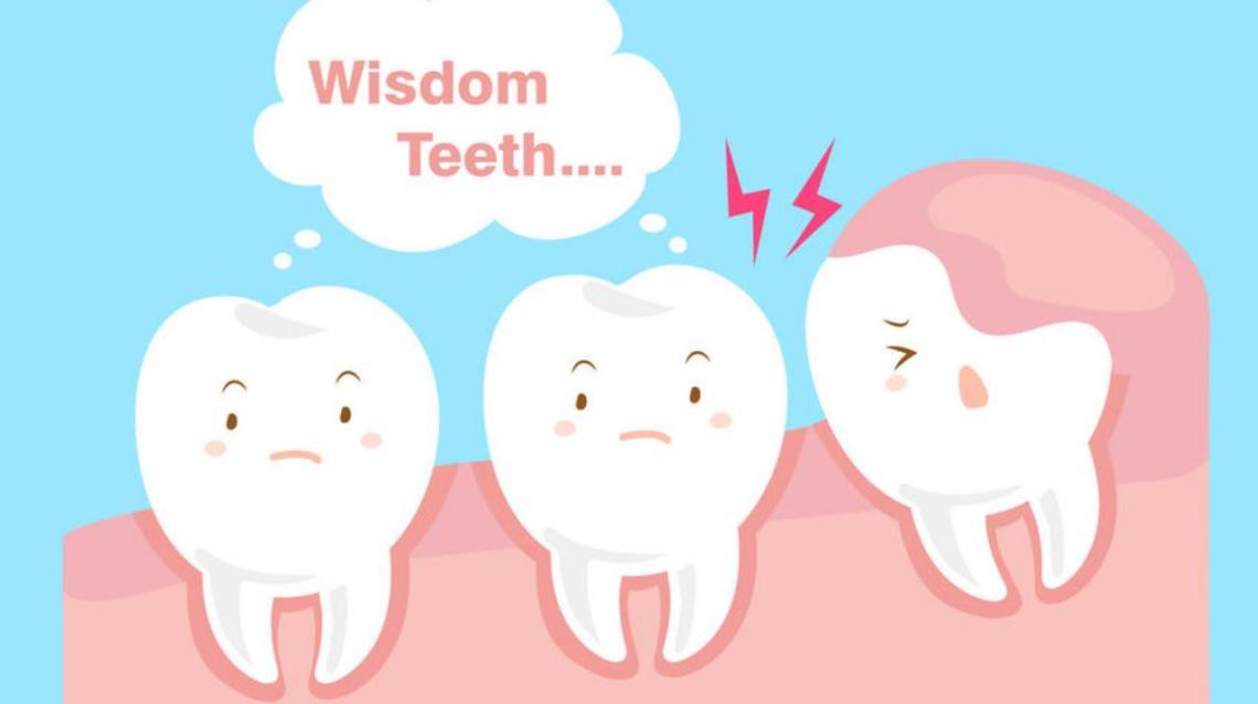 Bad Taste After Wisdom Teeth Removal Hi 4 Days After Having Practo Consult
