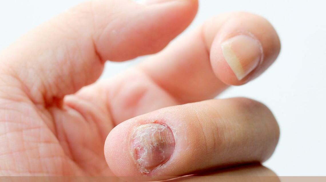 Can a Dermatologist Help With Nail Problems? Signs You Shouldn’t Ignore