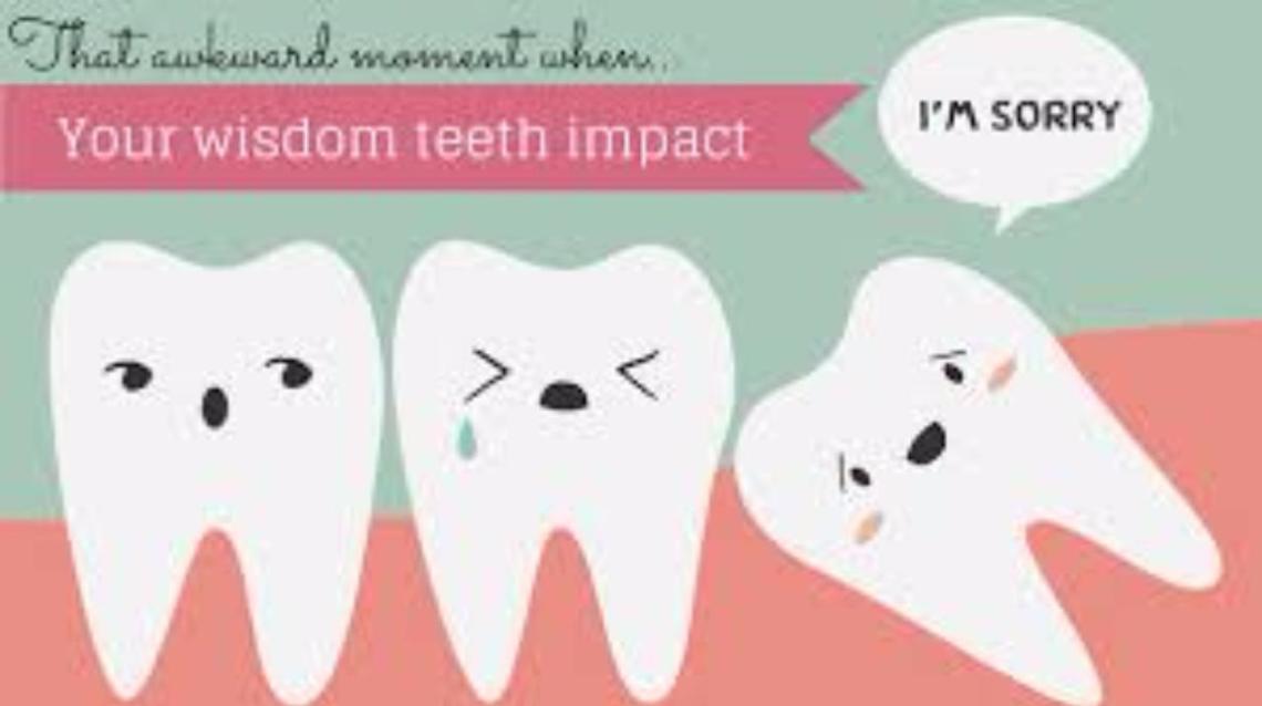 Incorrect 3rd Molar Erruption causes.......