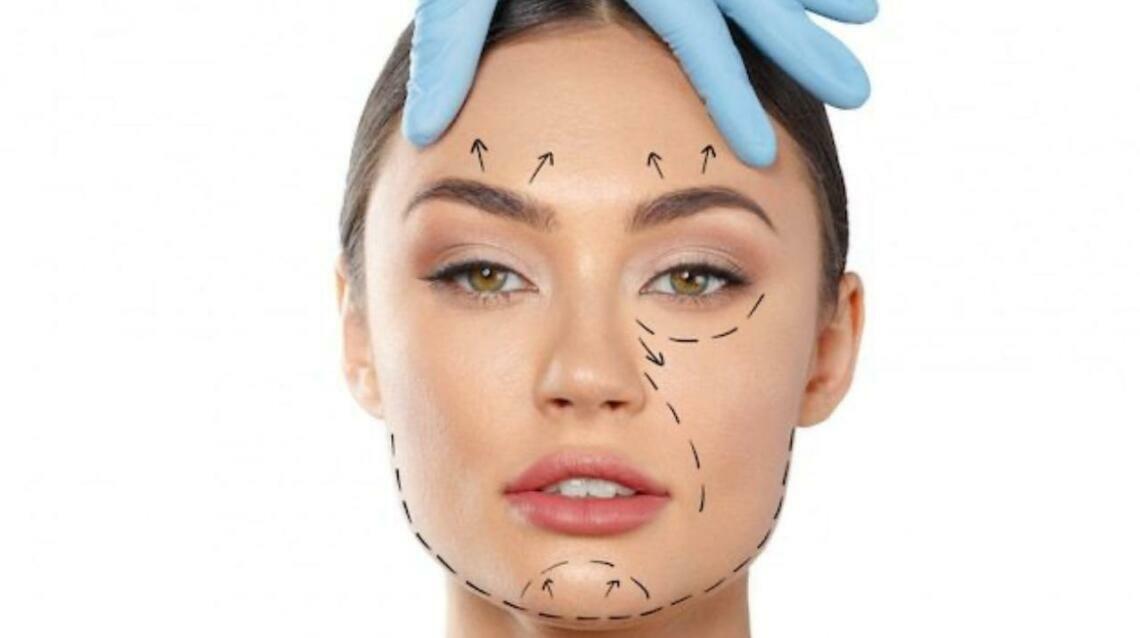 Facial Cosmetic Surgery