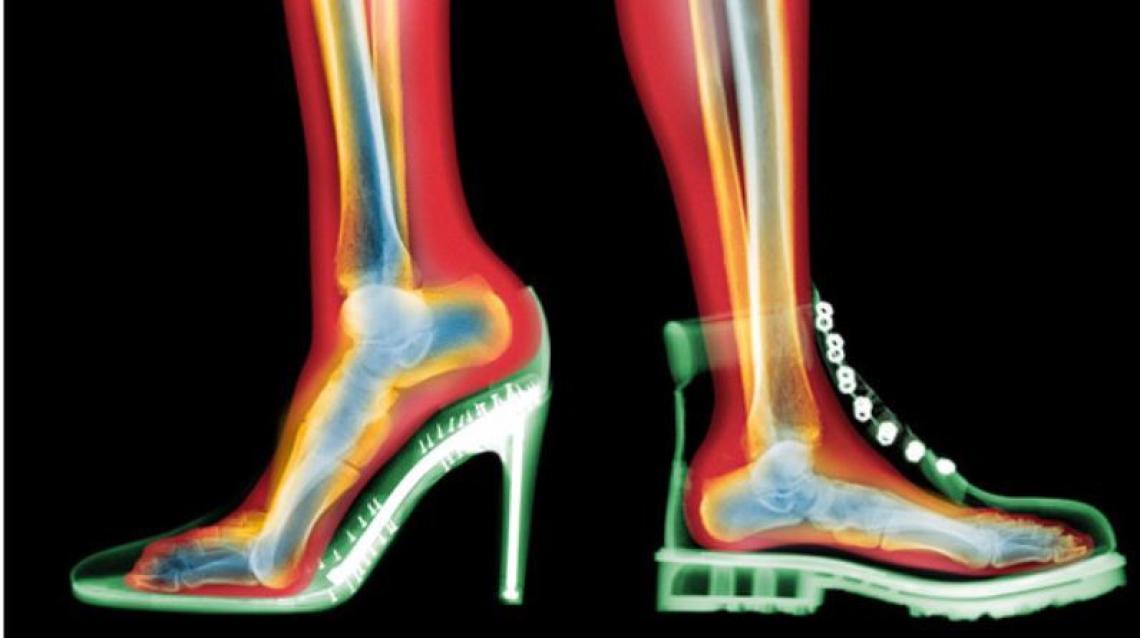 Footwear With Heels And Their Biomechanical Impact On Heel Pain