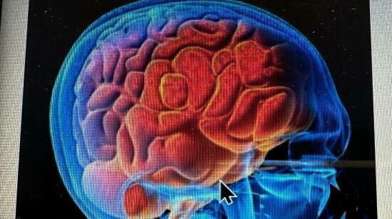 Meningitis - Brain Infection