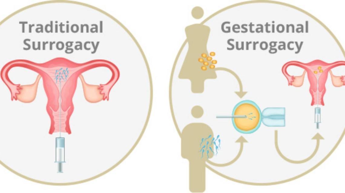 Types of Surrogacy – India Ivf Fertility Center (Noida / Delhi /Gurgaon)