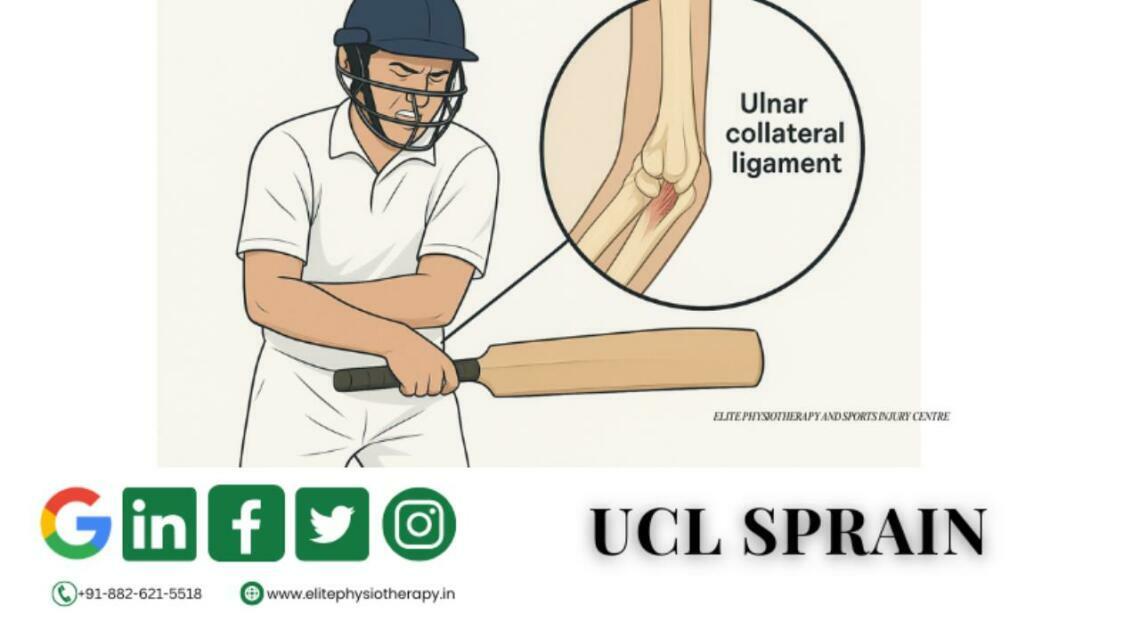Ucl Sprain: Modern Treatment, Better Recovery