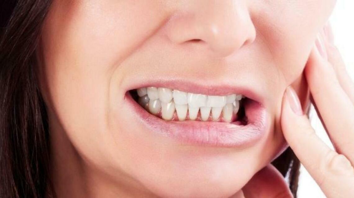 Bruxism (Teeth Problems)