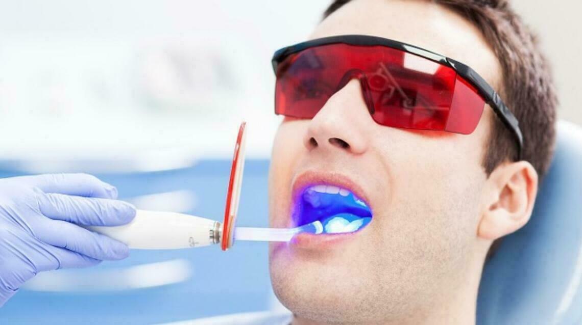 LaserAssisted Root Canal Therapy