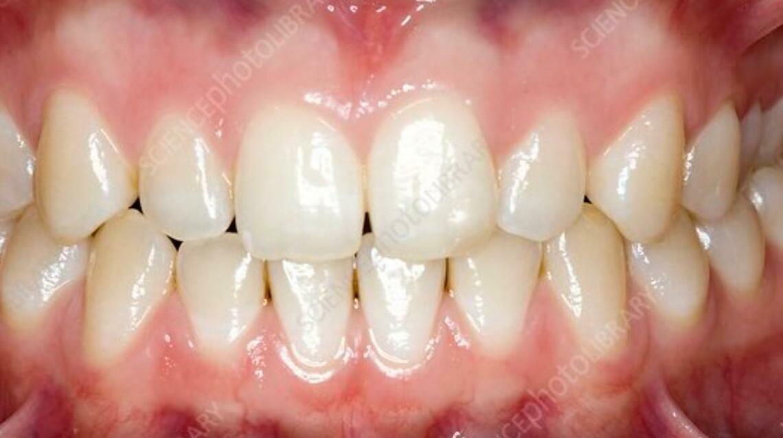 What Countries With Healthy Teeth Do Differently