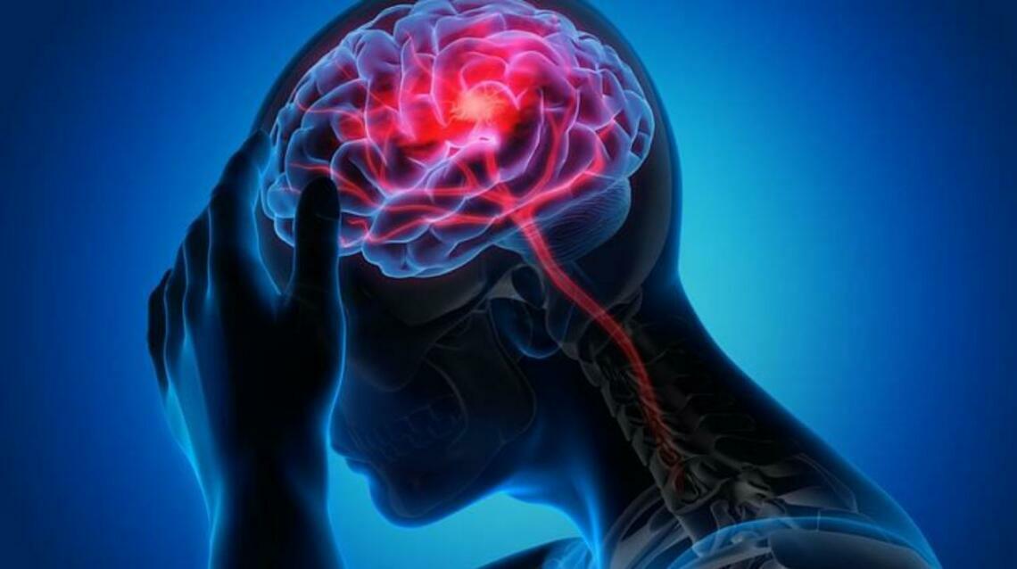 Headache Red Flags Requiring Urgent Mri/ct Scan