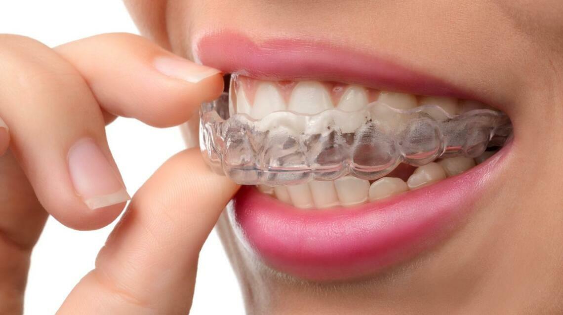 Does Invisalign Hurt? Understanding Pain and Discomfort