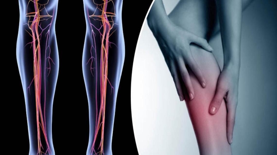 Deep Vein Thrombosis (DVT) and Pulmonary Embolism (PE): Threats to a healthy life