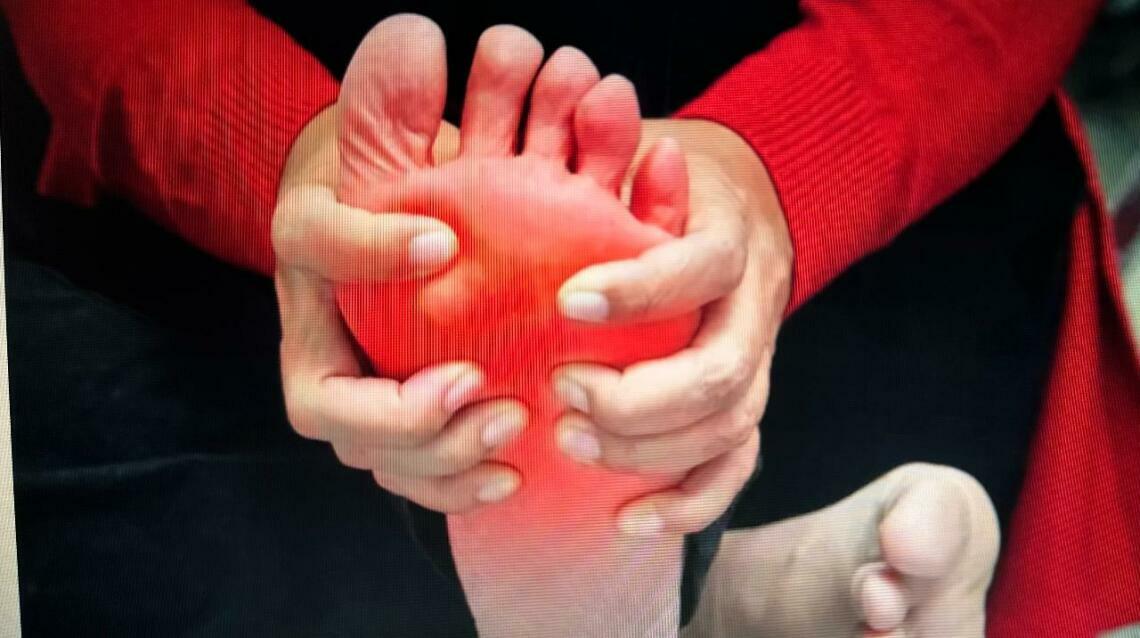 Burning Feet Syndrome