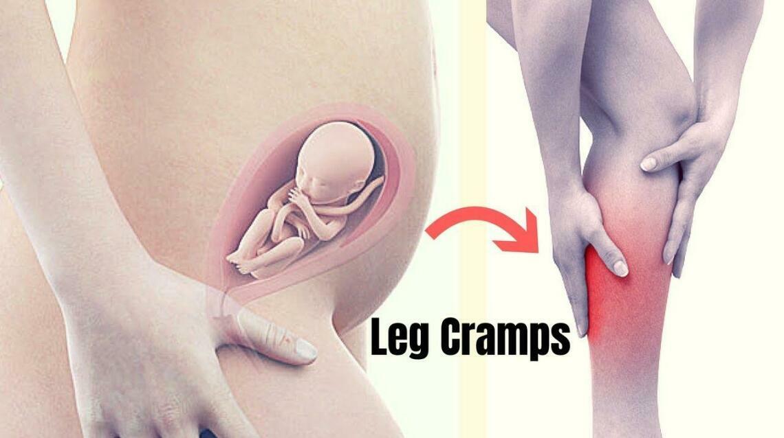 Leg Cramps During Pregnancy