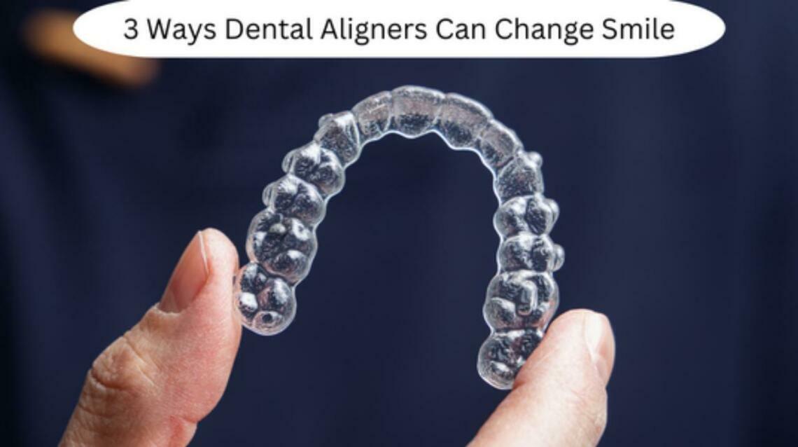 3 Ways Dental Aligners Can Change Smile