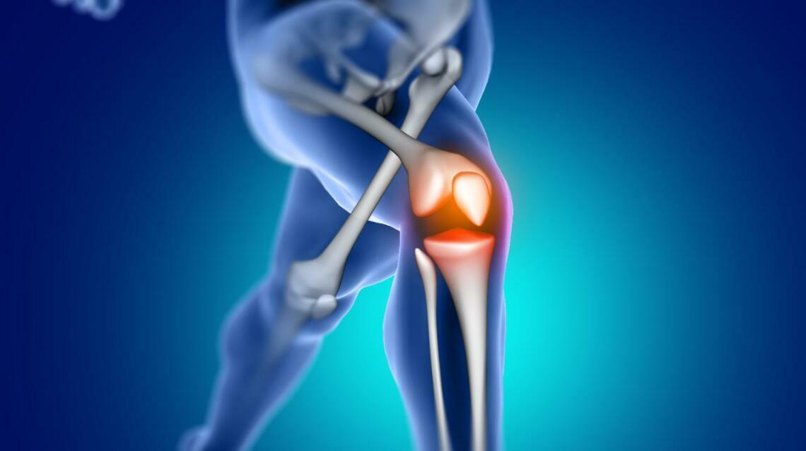 When Is Knee Replacement Surgery Necessary?