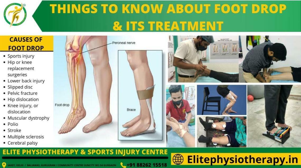 Things to Know About Foot Drop & Its Treatment