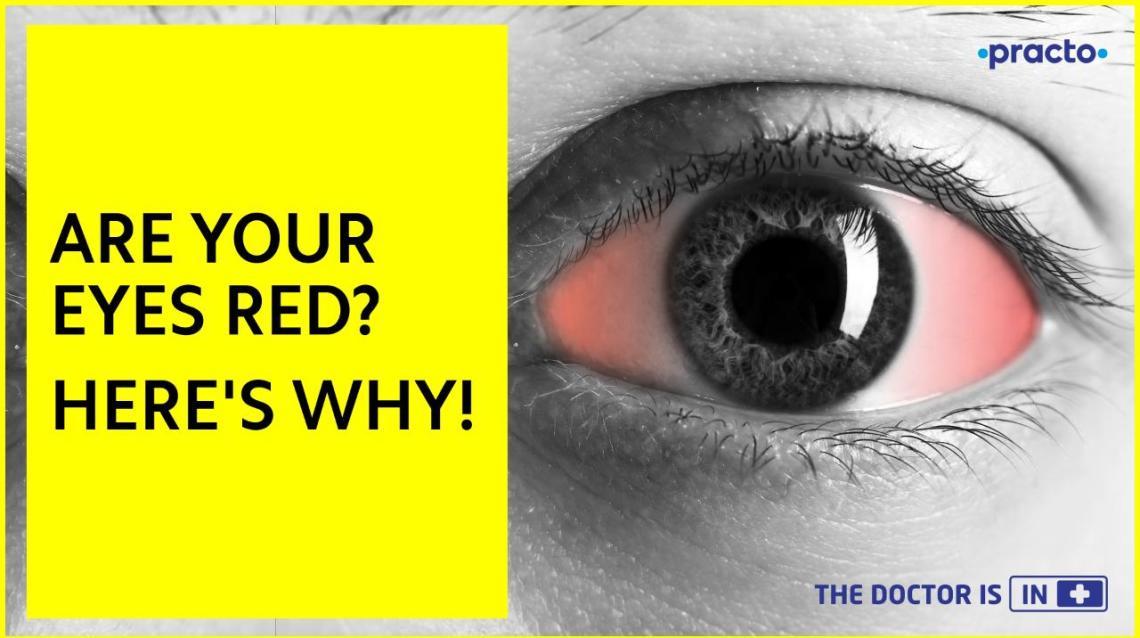 Video Article on Eye Redness Causes & Symptoms