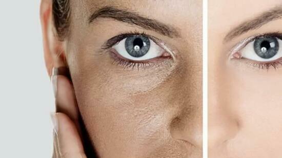 Dull Skin :What Is Really Causing It and How Can Dermatology Treatments Help?