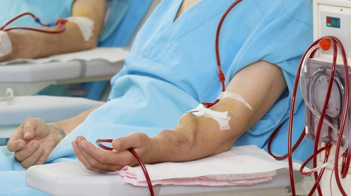 Av Fistula Surgery and Alternate Access Options for Dialysis Patients