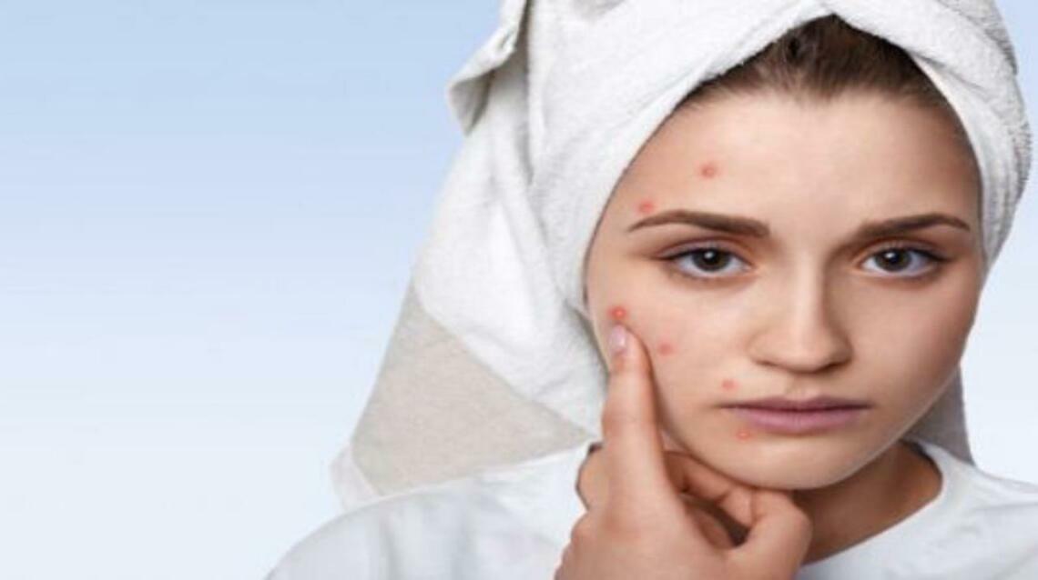 Advanced Acne Scar Removal Treatments You Should Know