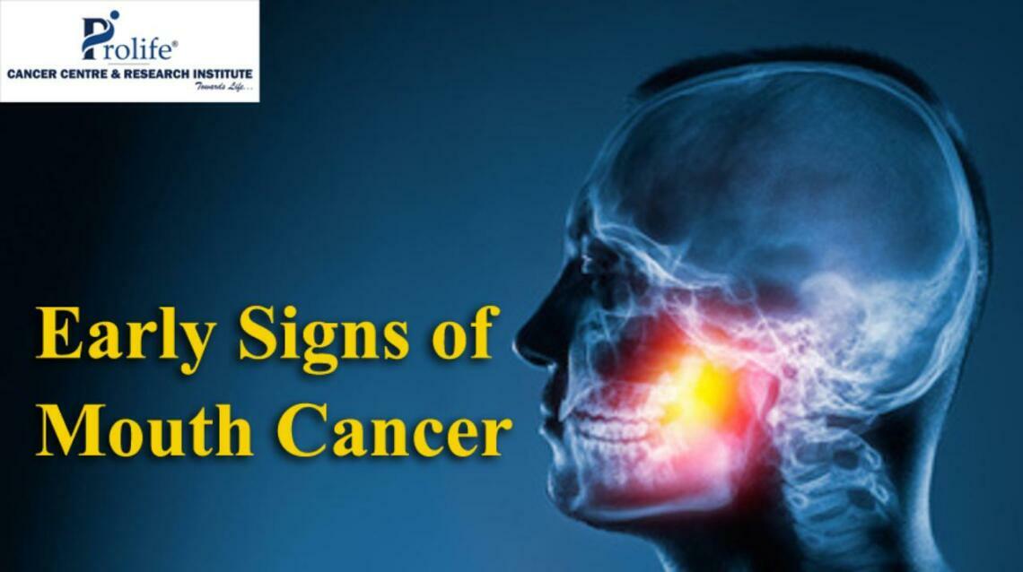 Early Warning Signs of Mouth Cancer You Should Never Ignore