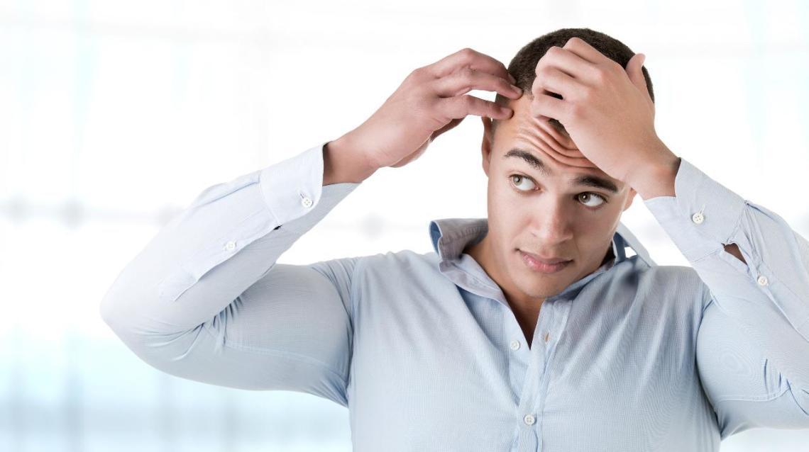 5 Things to Remember Before Hair Transplant