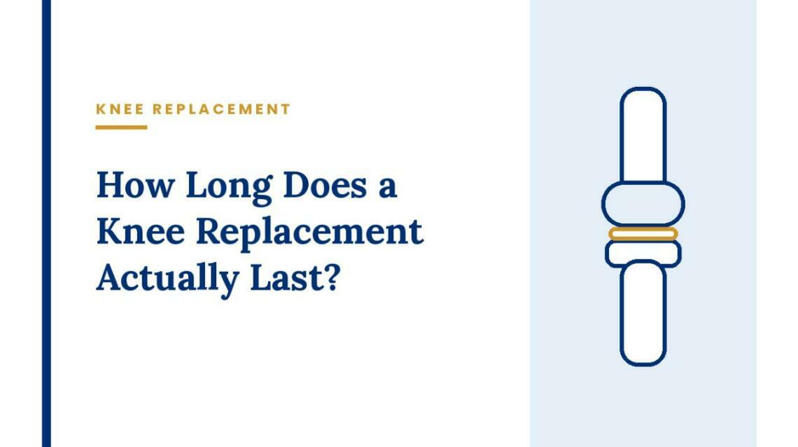 How Long Does a Knee Replacement Actually Last?