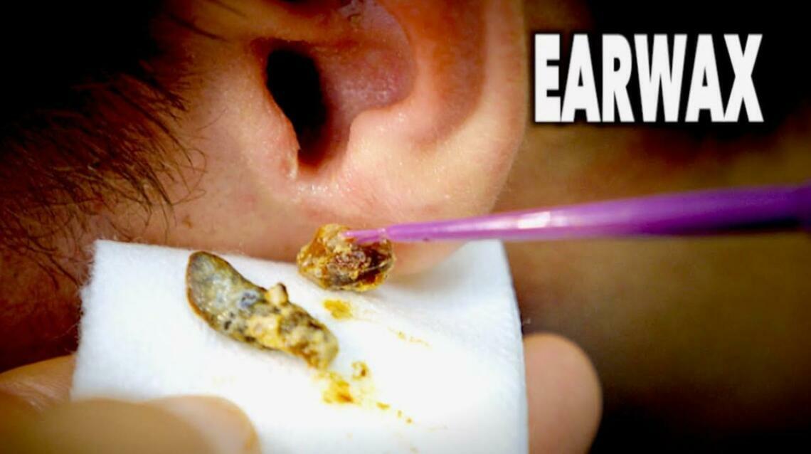 Is Ear Wax Protective? Know Why!